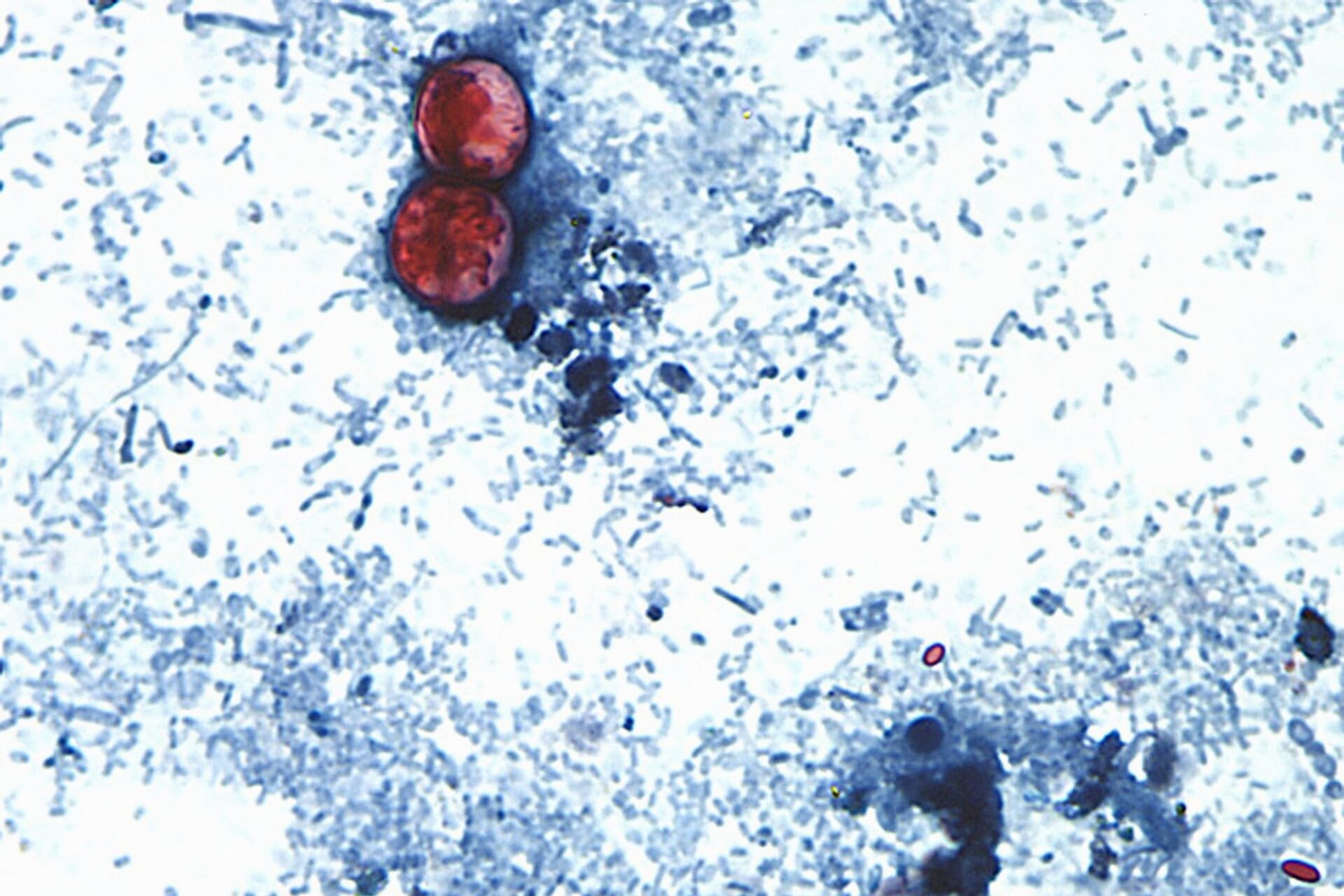 Le vuelven a echar la culpa a México: EU asegura que halló cyclospora en granja mexicana