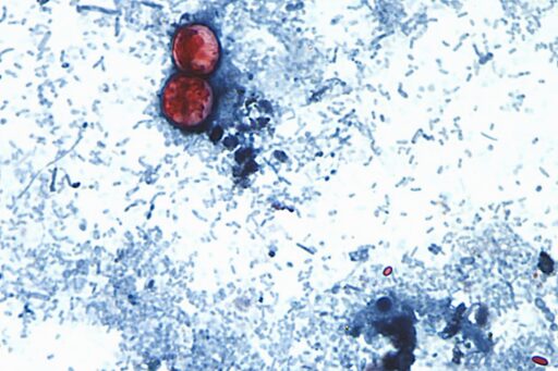 Le vuelven a echar la culpa a México: EU asegura que halló cyclospora en granja mexicana